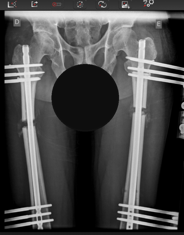 20240210 alongamento raiox fev2