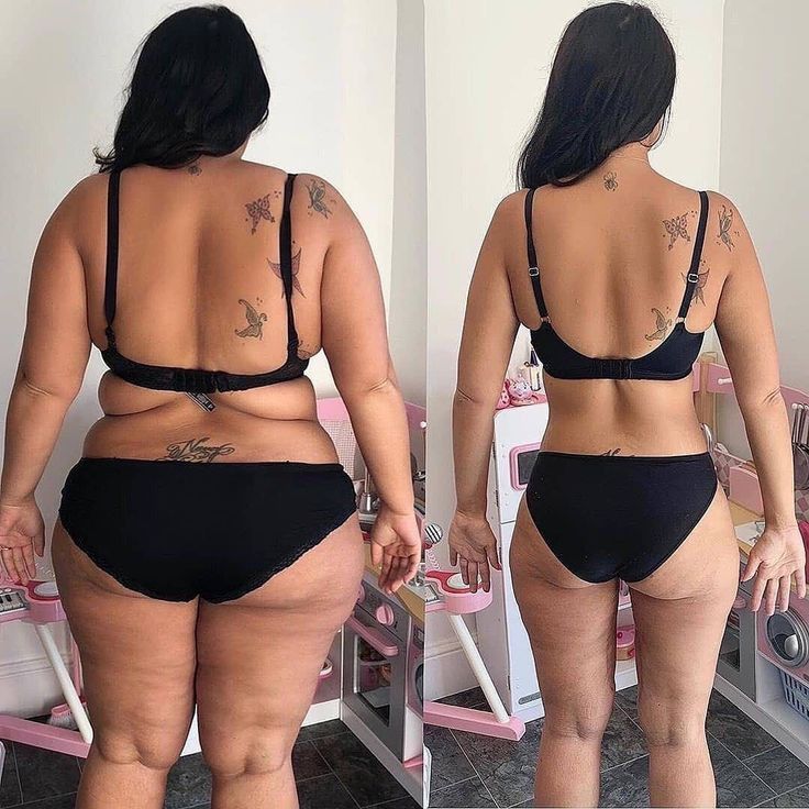 Antes e Depois