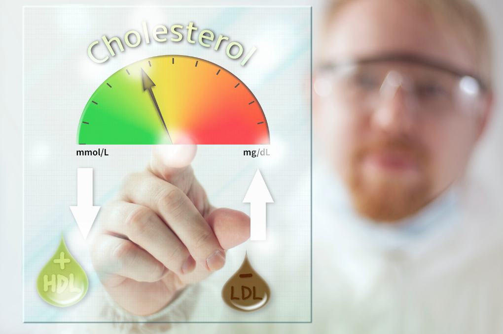 cholesterol management