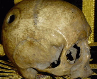 Le crâne de saint Aubert, fondateur du Mont-Saint-Michel IMG-3372
