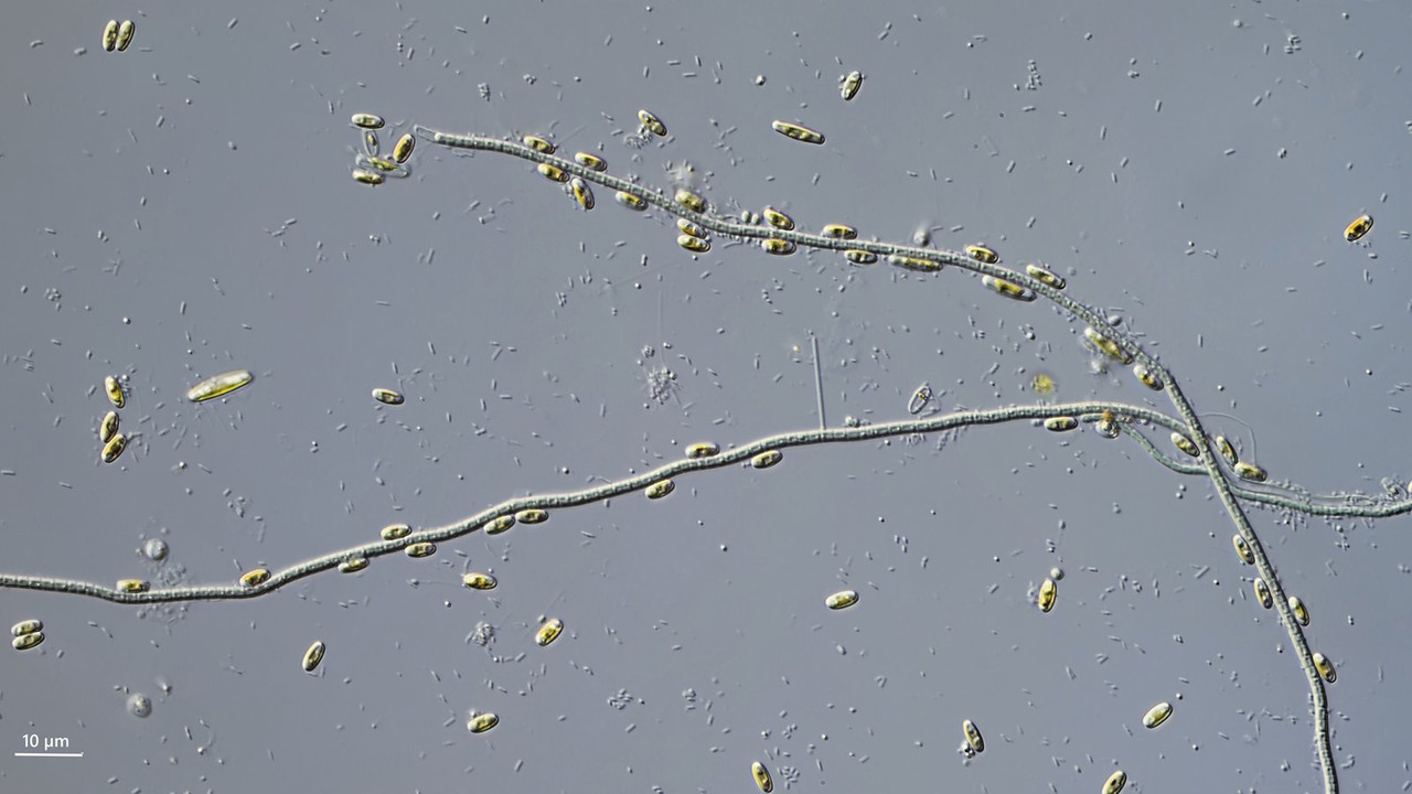 Pseudo-Anabaena 10 sp Ringelalge (Alg 308) Navicula sp DIK 50-Z7