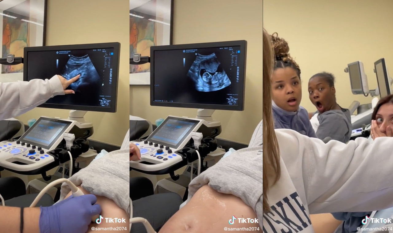 Estudiante de Medicina no sabía que estaba embarazada, lo descubre en clase