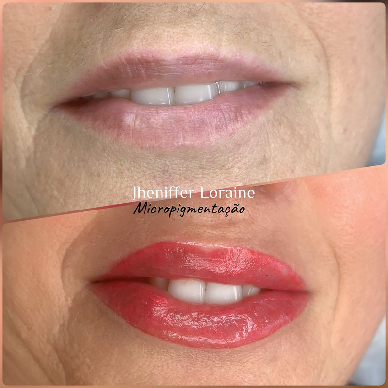 Flow Lips resultado premium