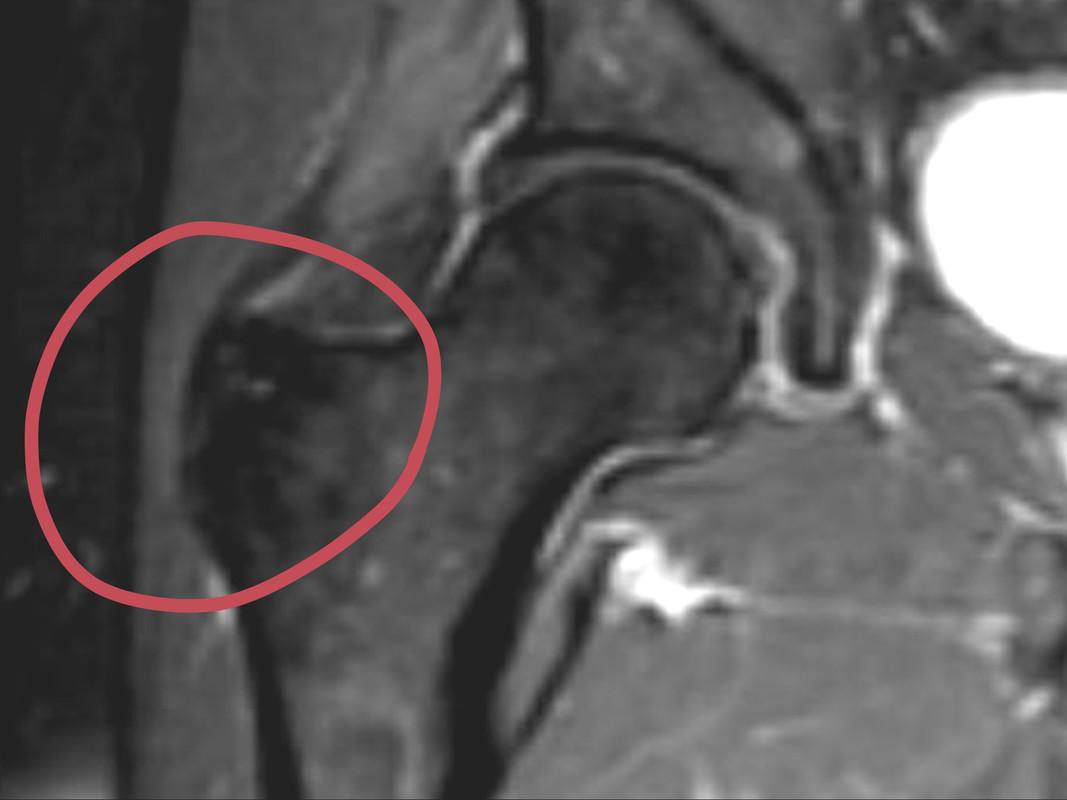 1FC388FF-6ACE-422E-8460-FE95EBCD2DD7