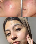 Skin Revive Result 3