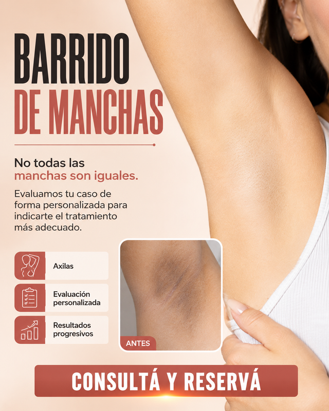 Barrido de manchas con láser en BELDAD Studio