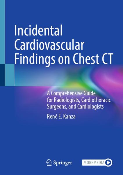 Incidental Cardiovascular Findings On Chest CT A Comprehensive Guide For Radiolog...