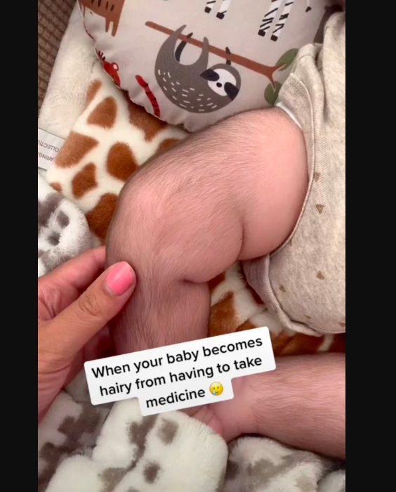 Mamá da medicamento a su bebé y este se vuelve super peludo; ya es viral