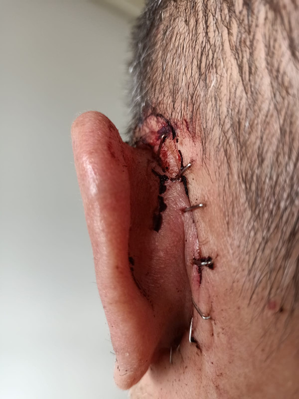 F4D309B4-2F15-49D9-ADA6-FF6EC1EF1E54