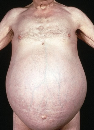 Gastroenterology question 4 image
