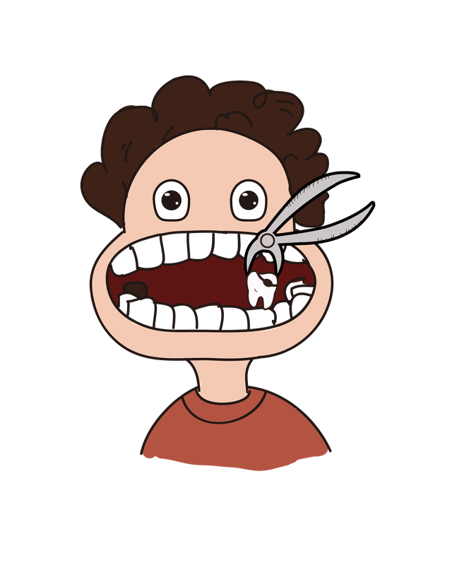 WISDOM TOOTH REMOVAL