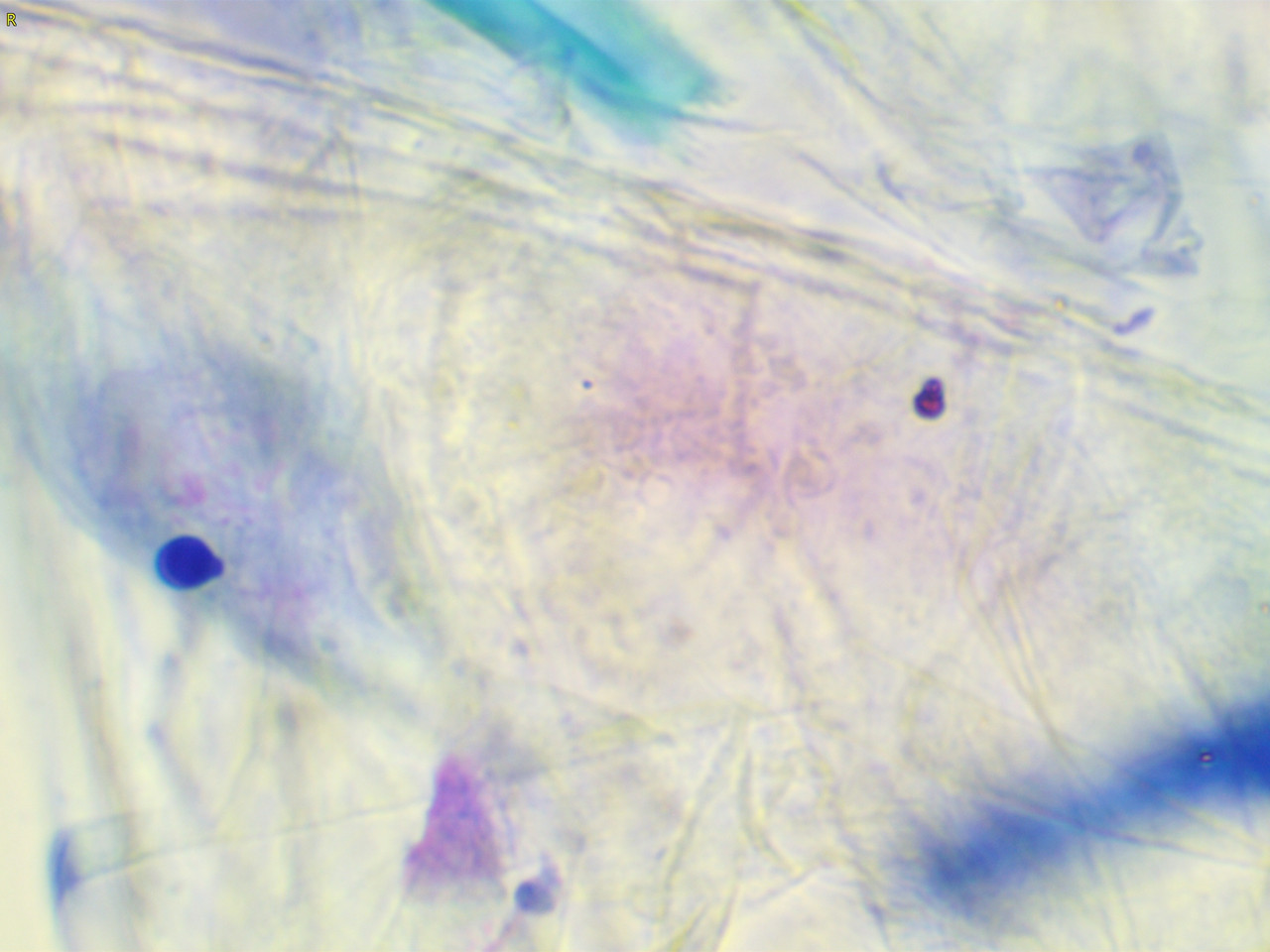 23207 177261 Into CNS 000003