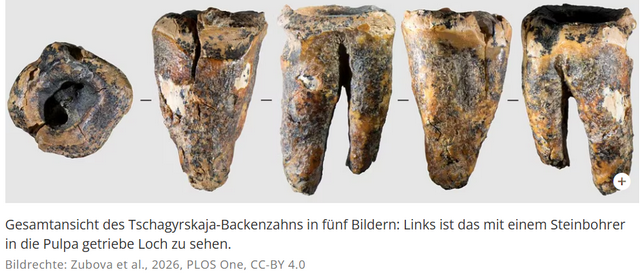 Backenzahn eines Neandertalers