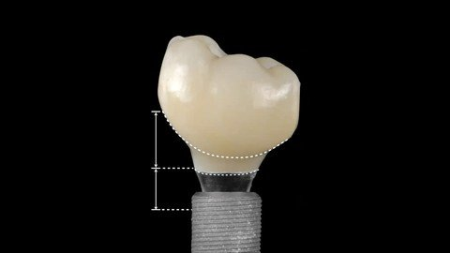 All You Need To Know About Digital Dentistry- Part I