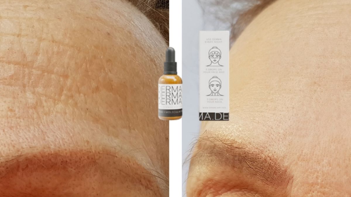 DERMA Lifting-Serum