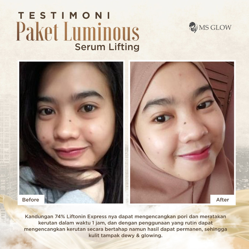 testimoni ms glow skin care