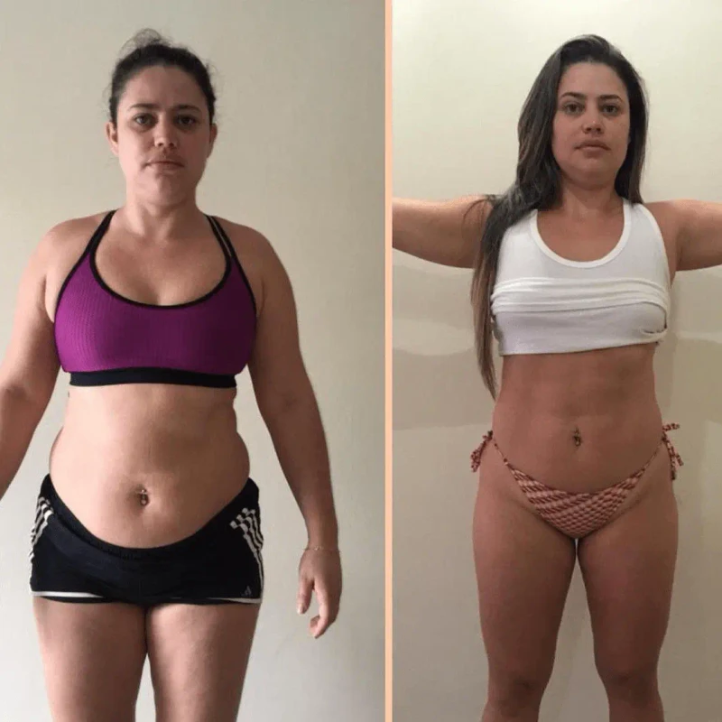 Laura M. - Reducción de abdomen