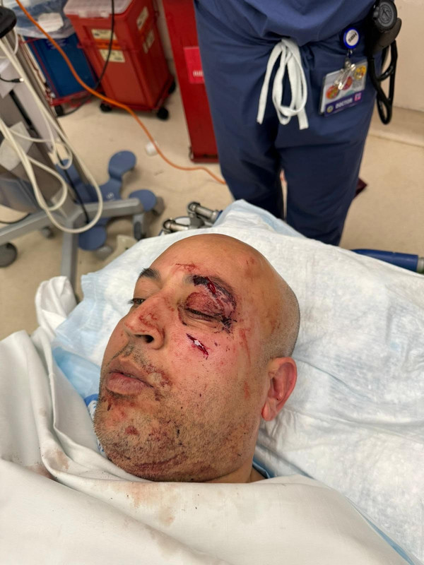 photo-shows-injuries-nypd-lieutenant-72237310