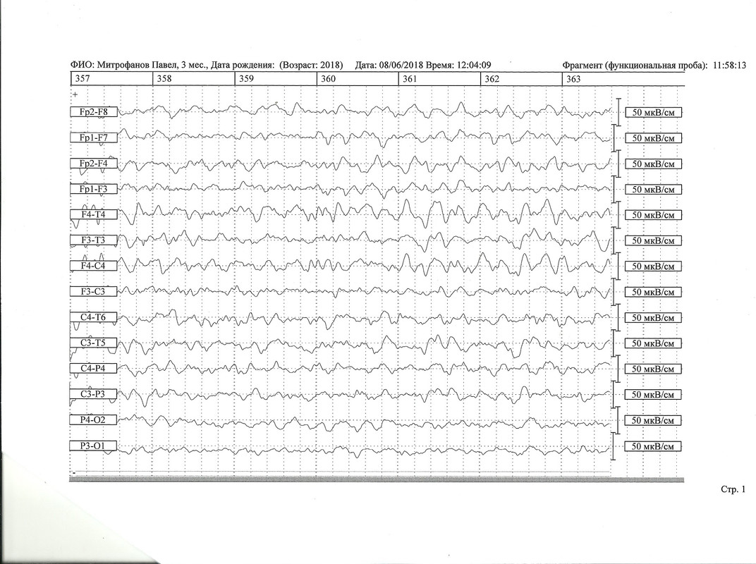 сканирование0006