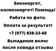 Выпадение волос после ковида отзывы