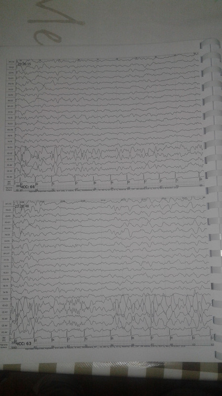 1510522906187-2136262748