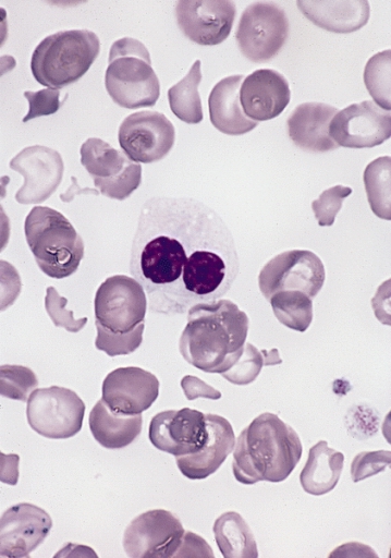 Hematology question 9 image