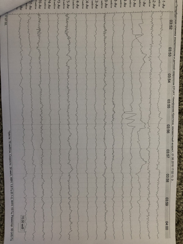 985B6F17-8963-40F0-A3D7-15E8646311DA