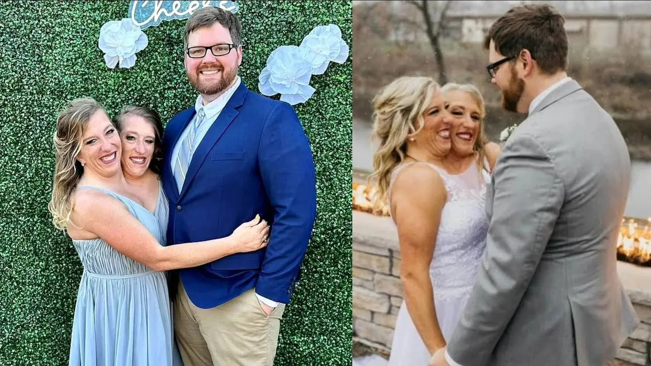 Gemelas siamesas rompen el silencio y confiesan todo sobre su vida sexual