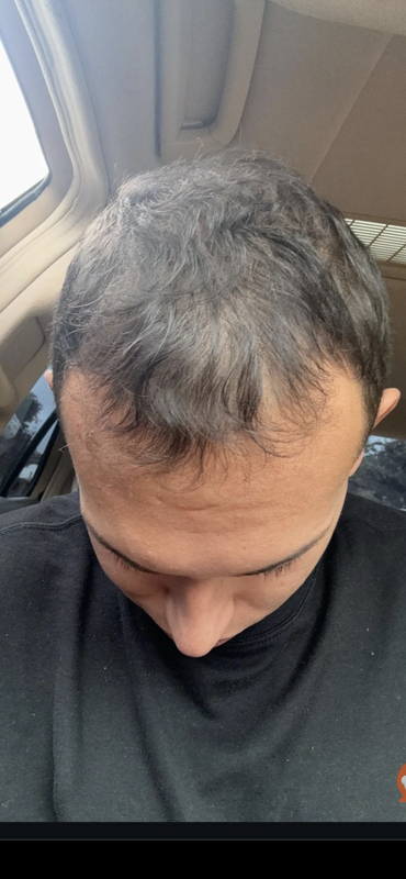 3B7971CA-4BA4-4457-A7D8-7860BD7EFFEA