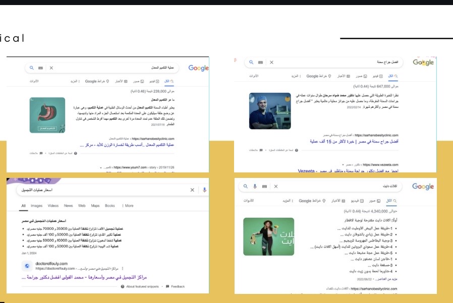سيو طبي التكميم والتجميل