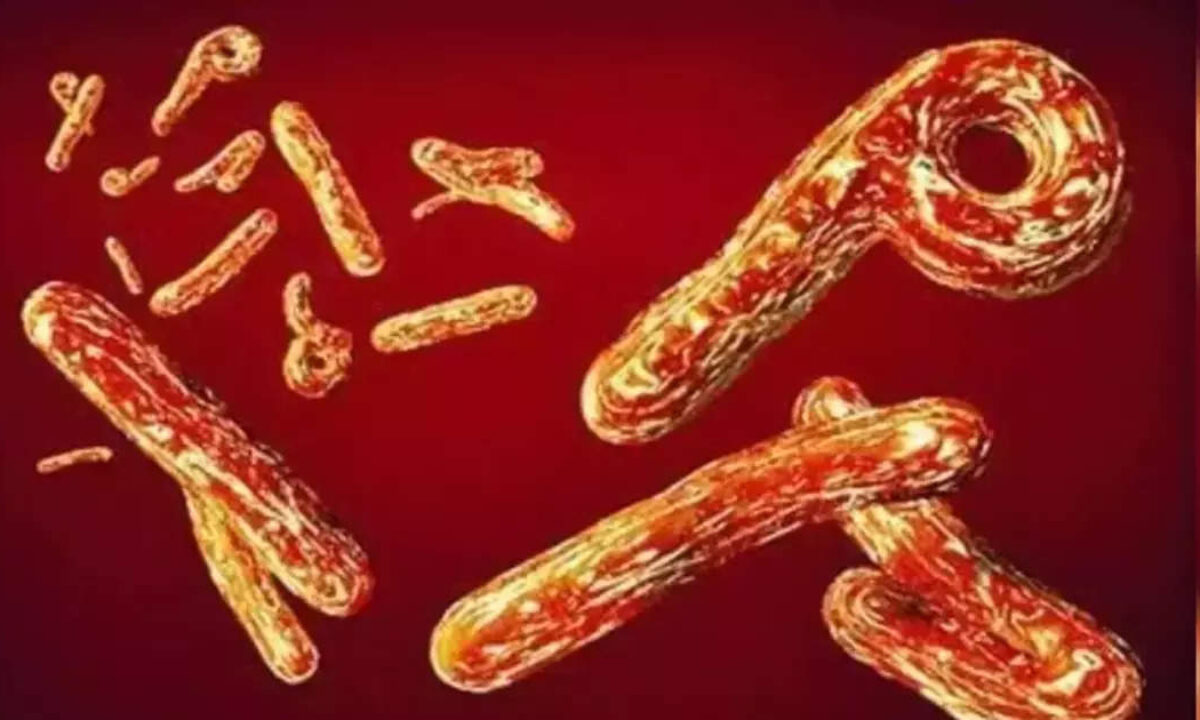 Tanzania Ebola Like virus Mysterious virus spread in Tanzania symptoms