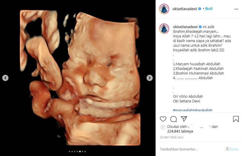 Foto Hasil USG calon anak keempat Oki Setiana Dewi
