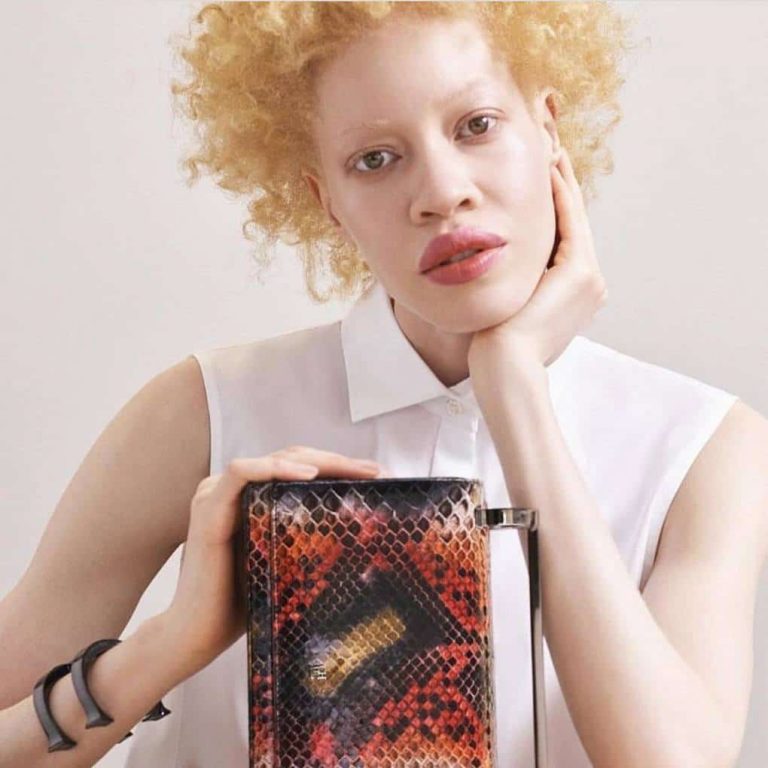 Афроамериканская модель с альбинизмом поразила всех своей необычной внешностью