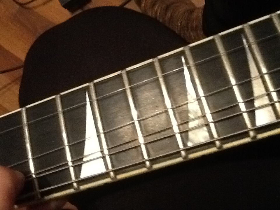 Frets