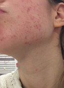 D4CAD6DE-5642-4B71-91D4-2944982508E5