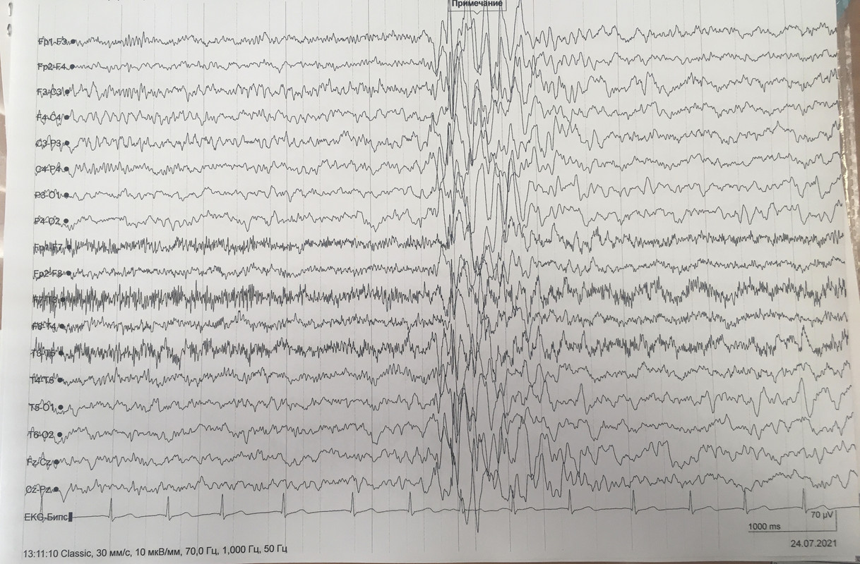 2099580C-A0F2-4D37-944F-B024B8F4A3DD