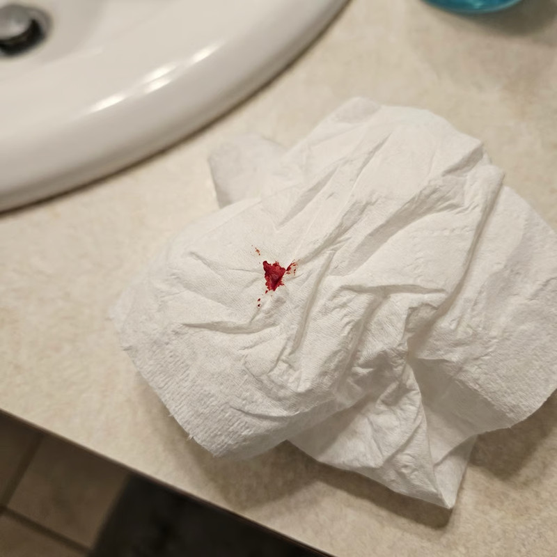 Hemorrhoid Relief