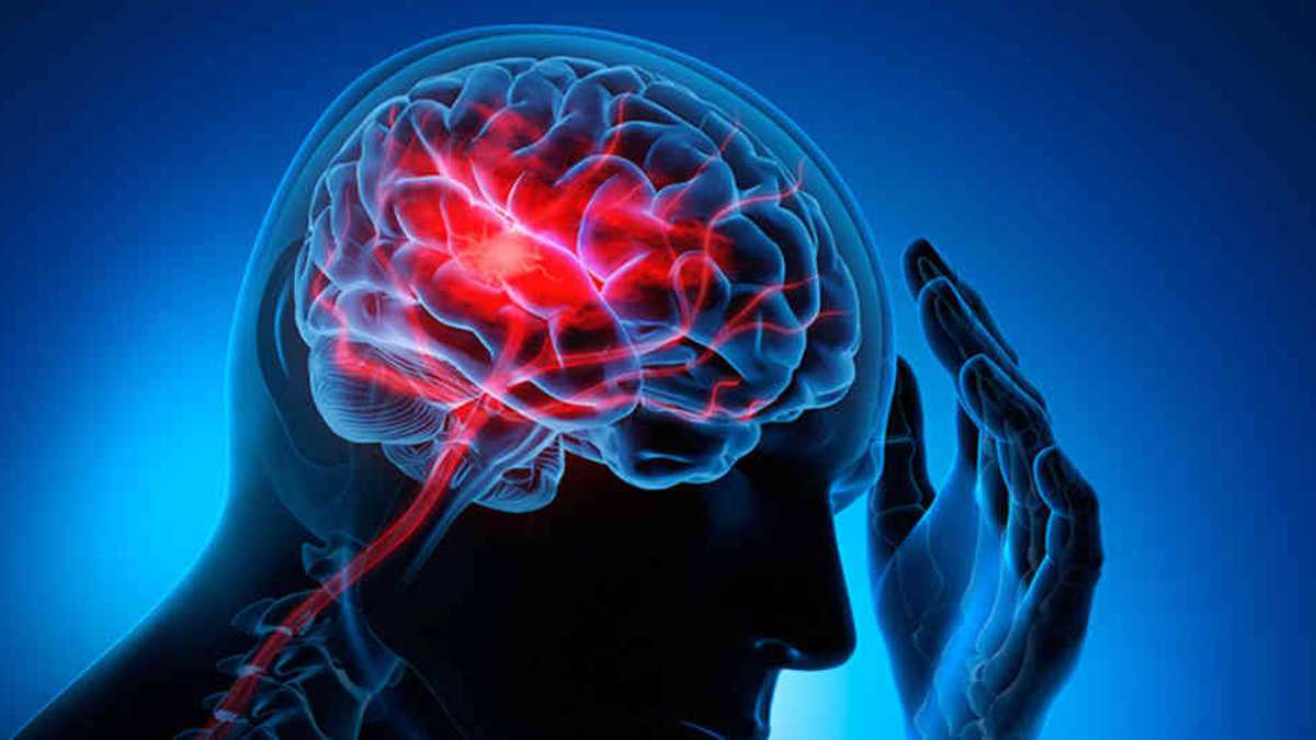 Vivir sin la mitad del cerebro ¿es eso posible?