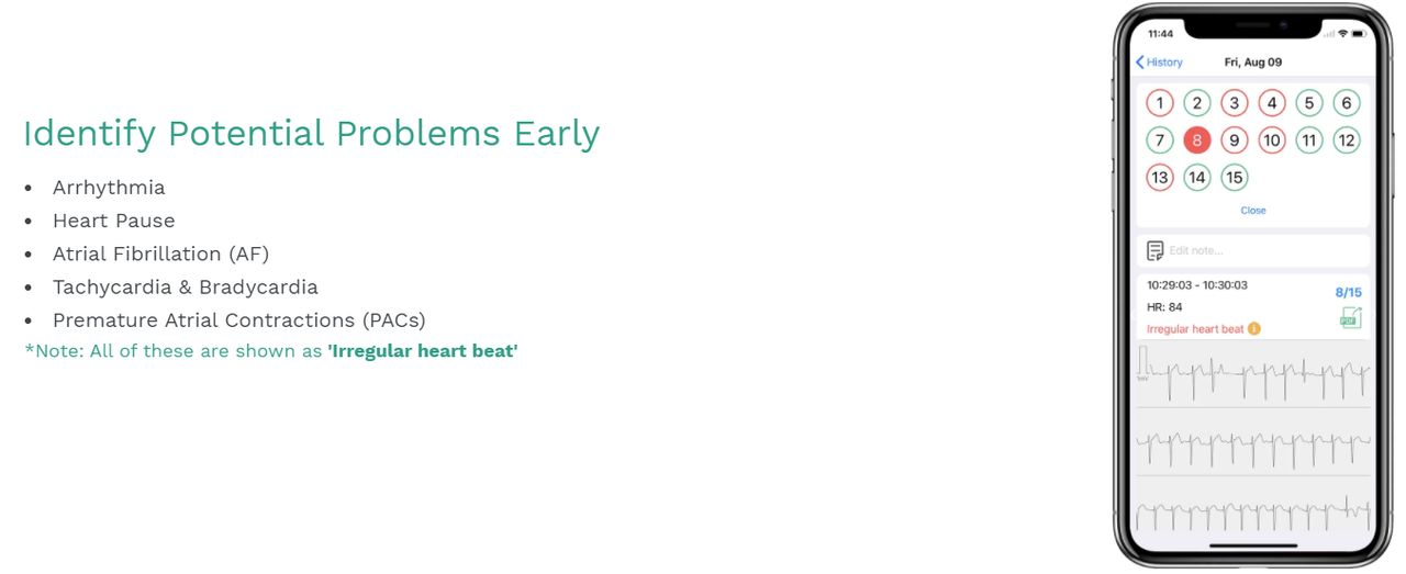 • Wellue DuoEK Wearable EKG/ECG Monitor 