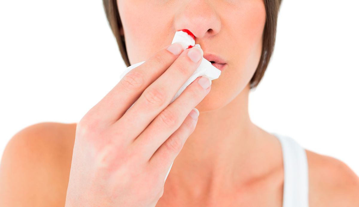 ¿Qué vitamina falta cuando se presenta sangrado nasal?