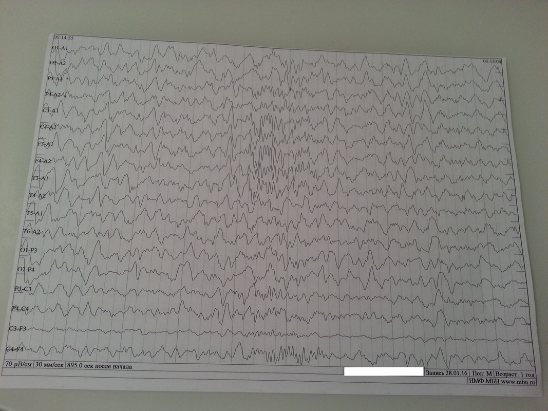 ээг 1 год с.3