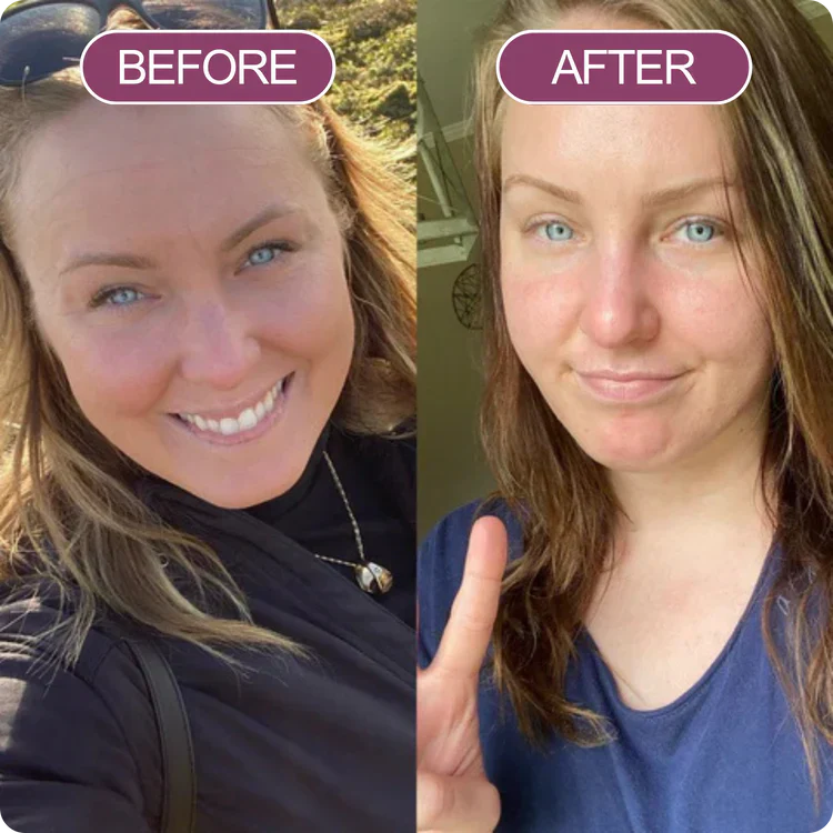 Before and After Veloura