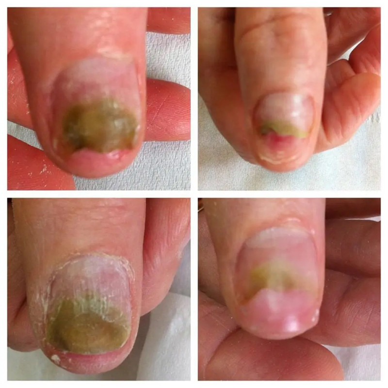 Depoimento cliente Micovax
