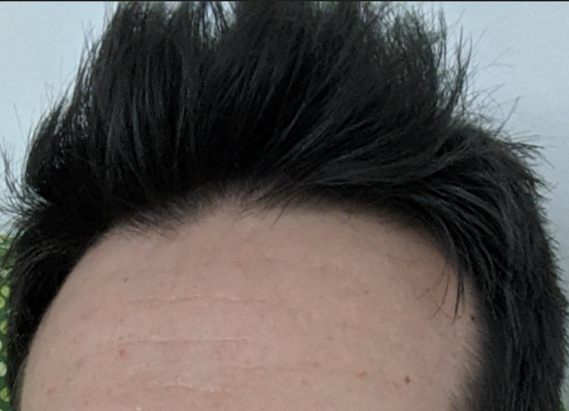 10. Agosto 2020. Capello sporco. Tenuto su senza problemi. Diradamento presente, ma i capelli erano 