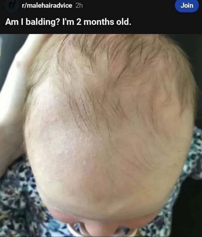 [Image: Balding.jpg]