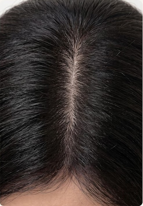 After - Scalp Therapy Comb