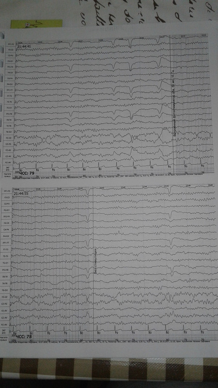 1510522389580-397856423