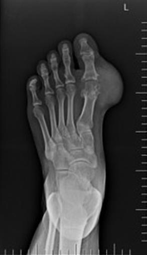 Rheumatology question 10 image