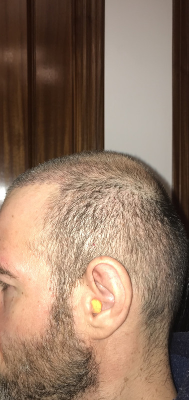 Foto 25-11-18 20 01 32