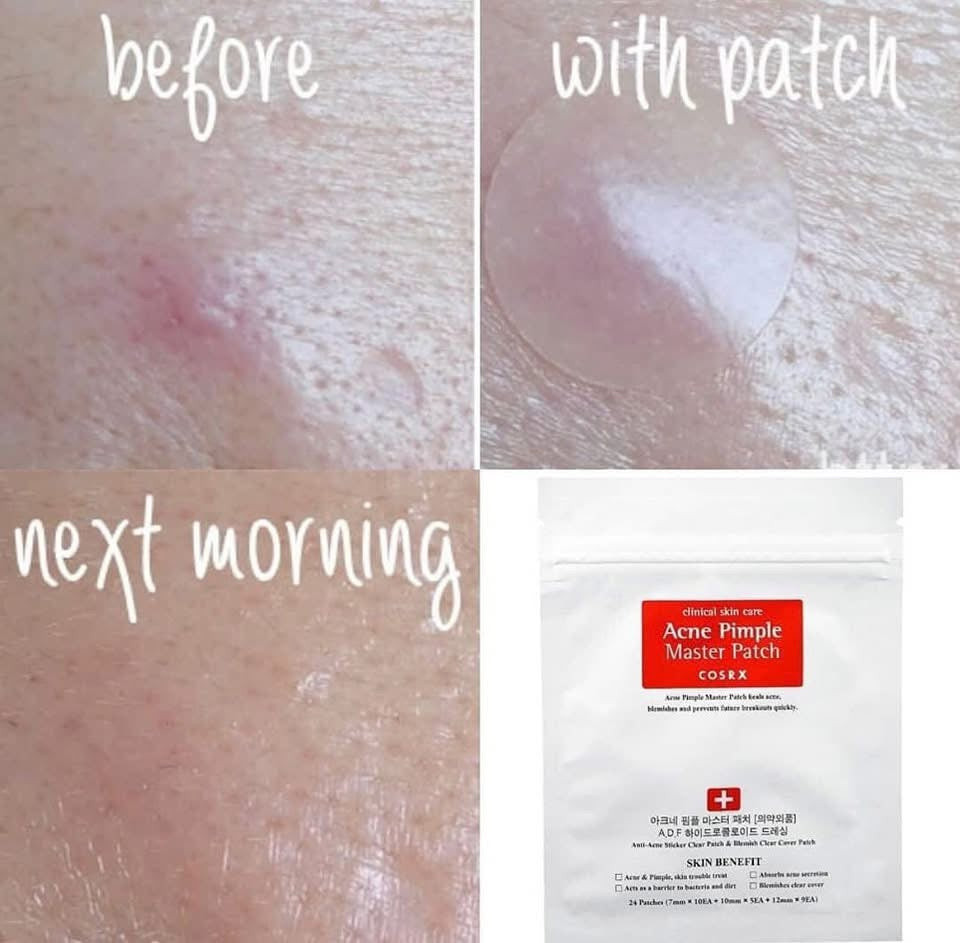 Cosrx Acne + Pimple Master Patches Pack .(24 Patches in one Pack). - image 3